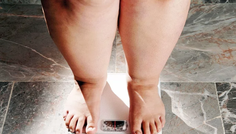 Un 70% de los puntanos sufre de sobrepeso y obesidad