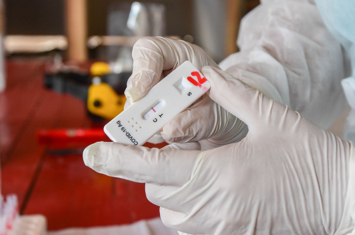 Reportaron 4.482 contagios de coronavirus en Argentina, un 27% menos que la semana pasada